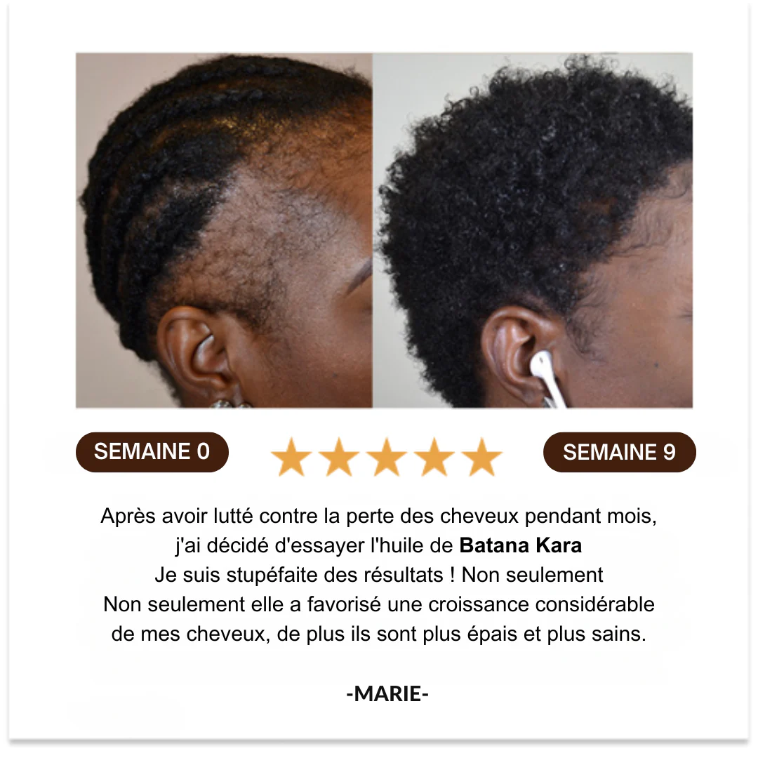 Huile de Batana™ | L'huile de croissance des cheveux, de traitement capillaire pure pour tous les types de cheveux