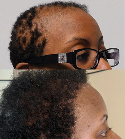 Huile de Batana™ | L'huile de croissance des cheveux, de traitement capillaire pure pour tous les types de cheveux